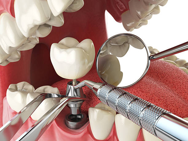 Best Emergency Treatment for Dental Infections or Abscesses in La Feria, TX